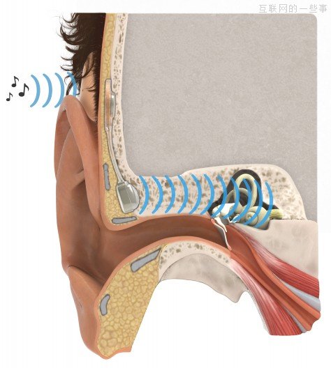 快刀青衣：骨传导技术，让女神上车不再睡觉,互联网的一些事