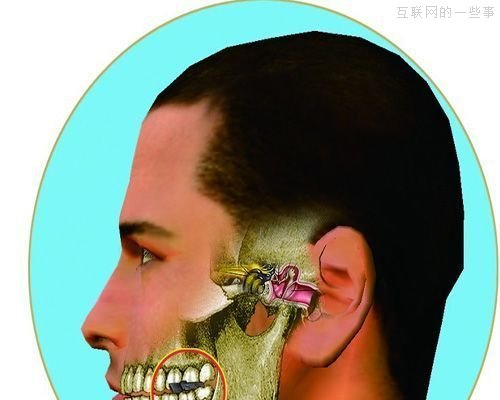 【组图】那些高科技的作弊手段,互联网的一些事